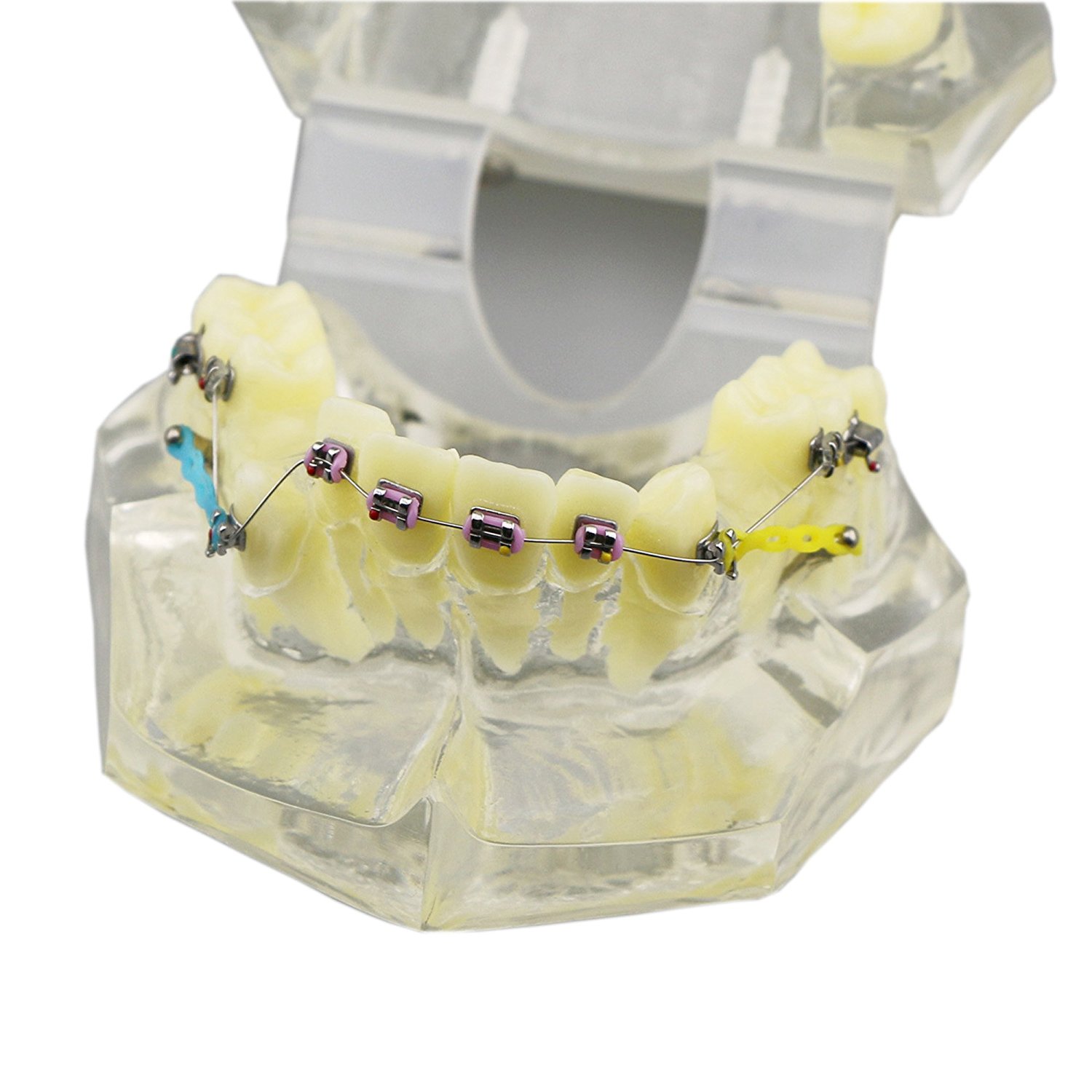 歯科上下顎180度開閉式歯列矯正模型 矯正歯科治療用研究用 ブラケット