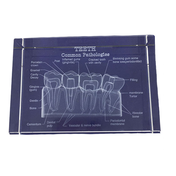 歯科水晶内部歯解剖図嵌め込み 歯科教学水晶置物歯科装飾品プレゼント 歯科クリニック名刺ホルダー通販 Dentalshop Jp